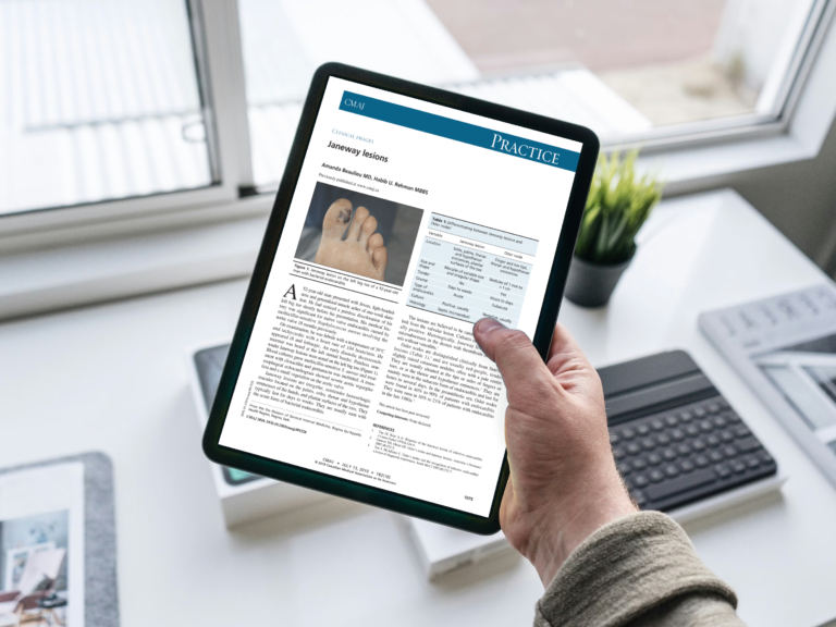 Czy plamy (wybroczyny) na stopach zawsze świadczą o chorobach stóp?