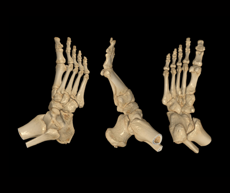 Anatomia stopy – dlaczego stopy są tak wyjątkowe?